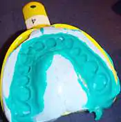 歯の型取り